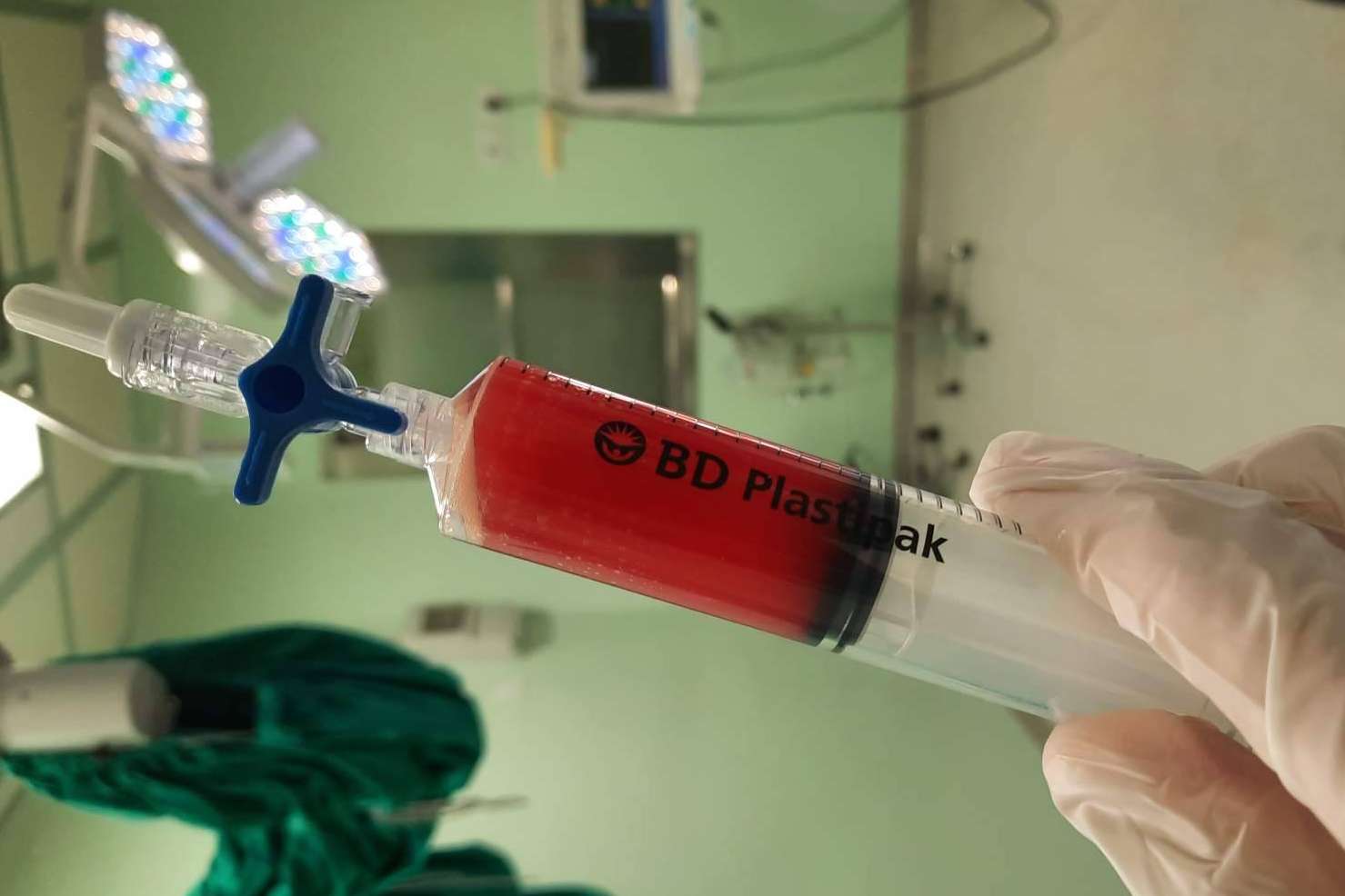 Medicina regenerativa para tratar el dolor de hombro, de la mano de Biorigenera