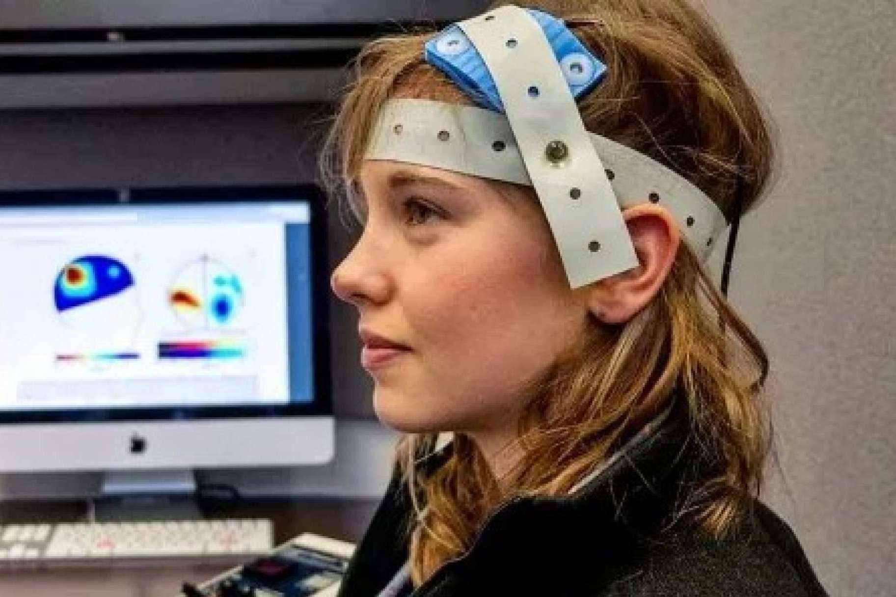 Vanguardia en tratamientos de salud mental con neuromodulación
