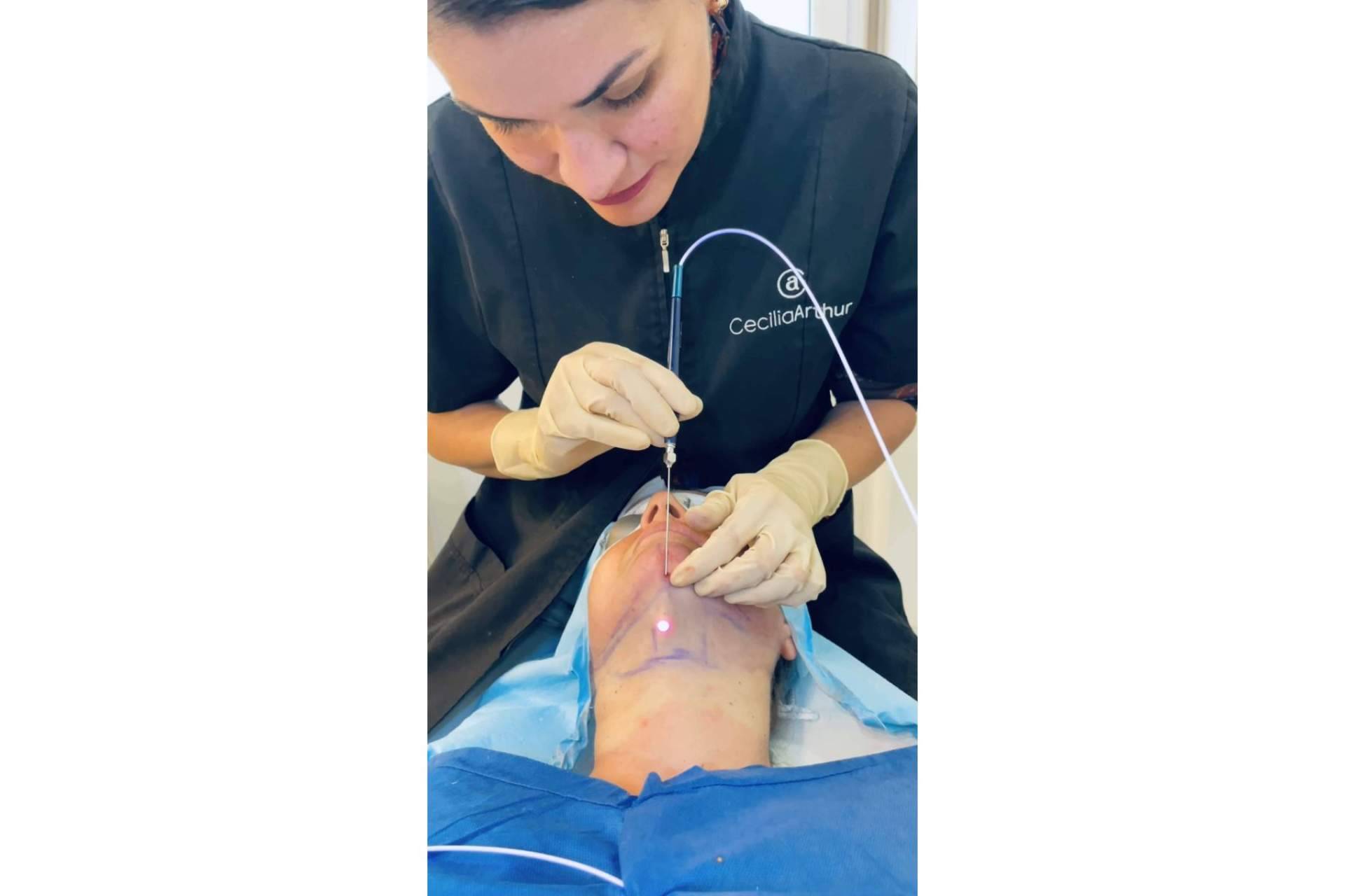 Beneficios del tensado de cuello con Klaser Blue, por la Dra. Cecilia Arthur
