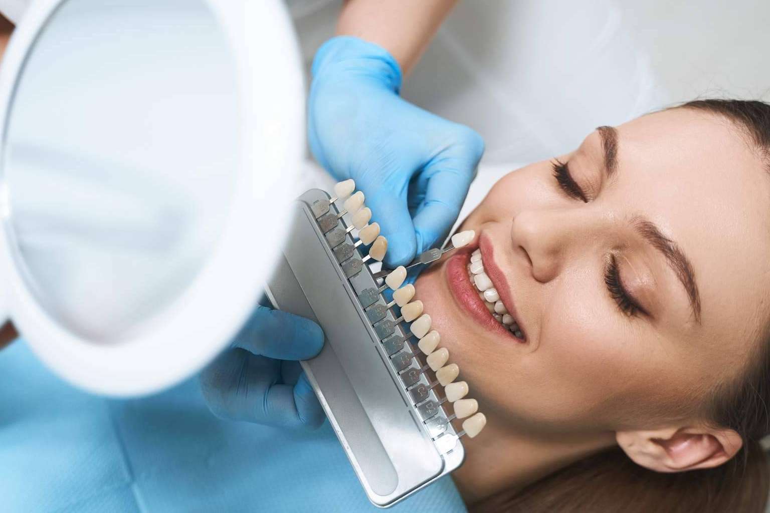 Los riesgos de la obsesión por el blanqueamiento dental