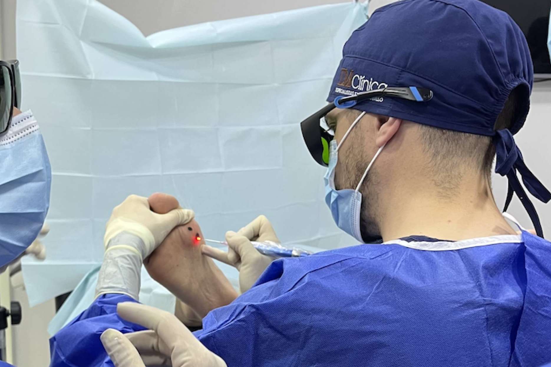 Nuevo tratamiento láser para la cirugía de uñas y los papilomas en el pie