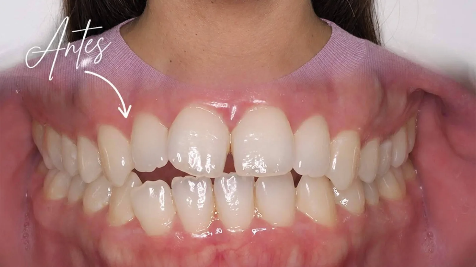 Clínica Calvo de Mora integra cirugía maxilofacial e implantología avanzada en tratamientos complejos